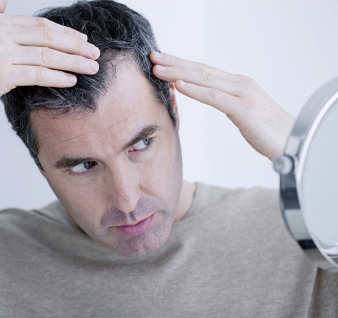 What are the side effects of hair transplantation?