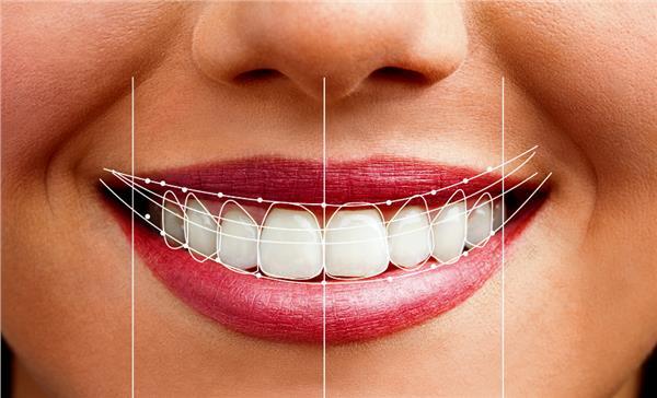 Smile Aesthetics