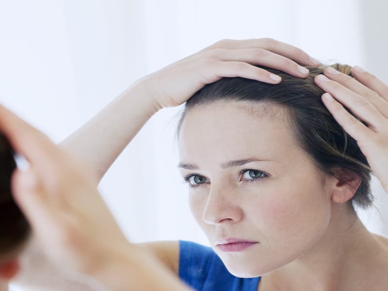 Can women have hair transplantation?